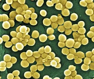 Bahaya Menicure ranker.com Bahaya Menicure ranker.com