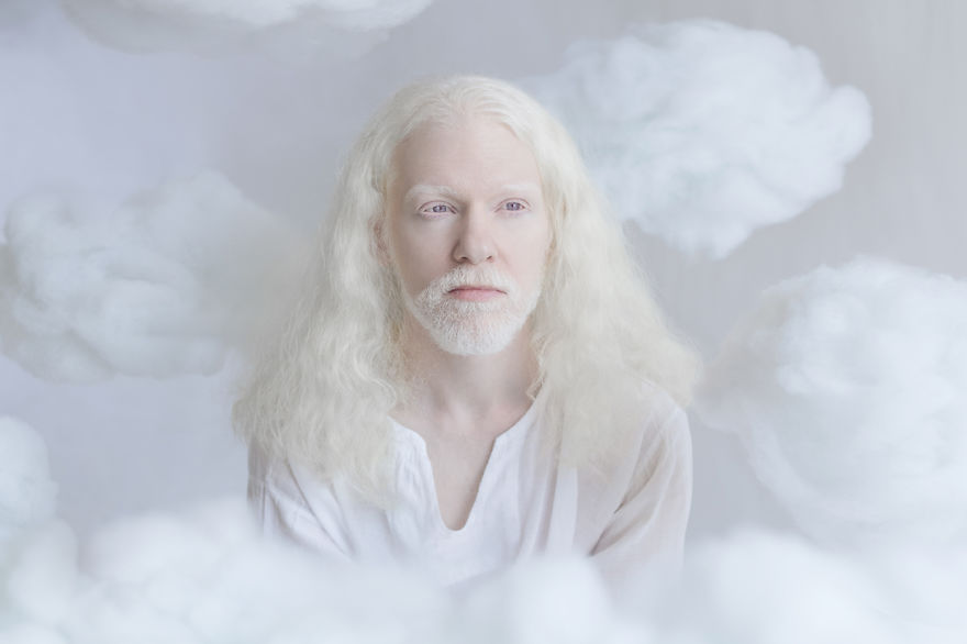 11 Potret orang albino ini eksotis banget, indahnya bikin takjub