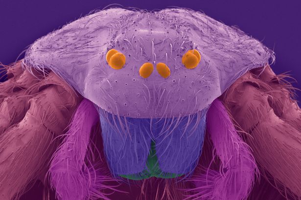 Foto mikro ini tunjukkan bakteri di rumah yang siap memakan kulitmu