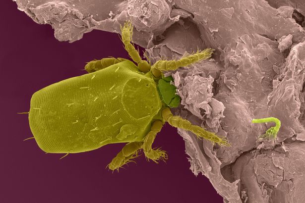 Foto mikro ini tunjukkan bakteri di rumah yang siap memakan kulitmu