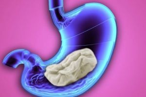 Terjawab sudah, ini yang terjadi kalau kamu menelan permen karet