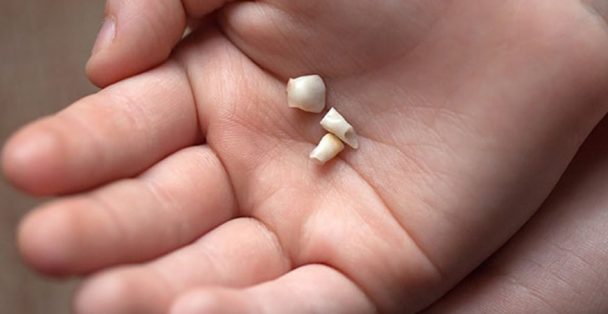 alasan gigi susu nggak boleh dibuang © 2016 berbagai sumber