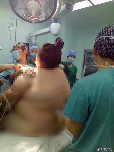 Foto perjuangan ibu dengan BB 127 kg saat melahirkan, bikin deg-degan