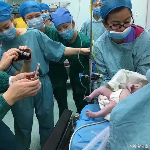 Foto perjuangan ibu dengan BB 127 kg saat melahirkan, bikin deg-degan