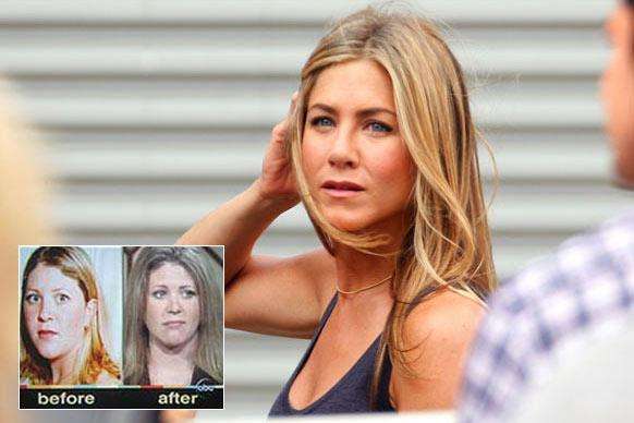 cewek oplas mirip artis © 2016 brilio.net cewek oplas mirip artis © 2016 brilio.net