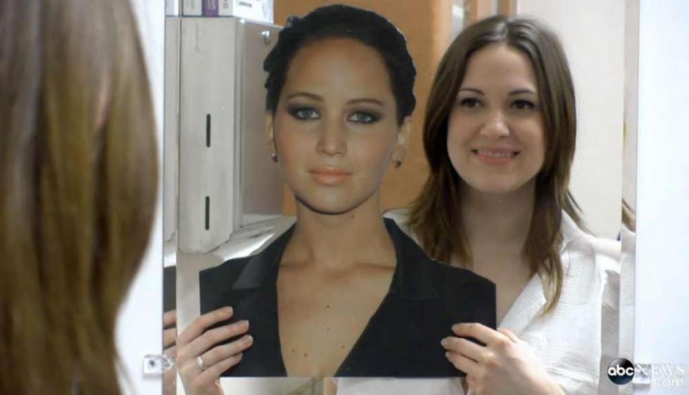 cewek oplas mirip artis © 2016 brilio.net cewek oplas mirip artis © 2016 brilio.net