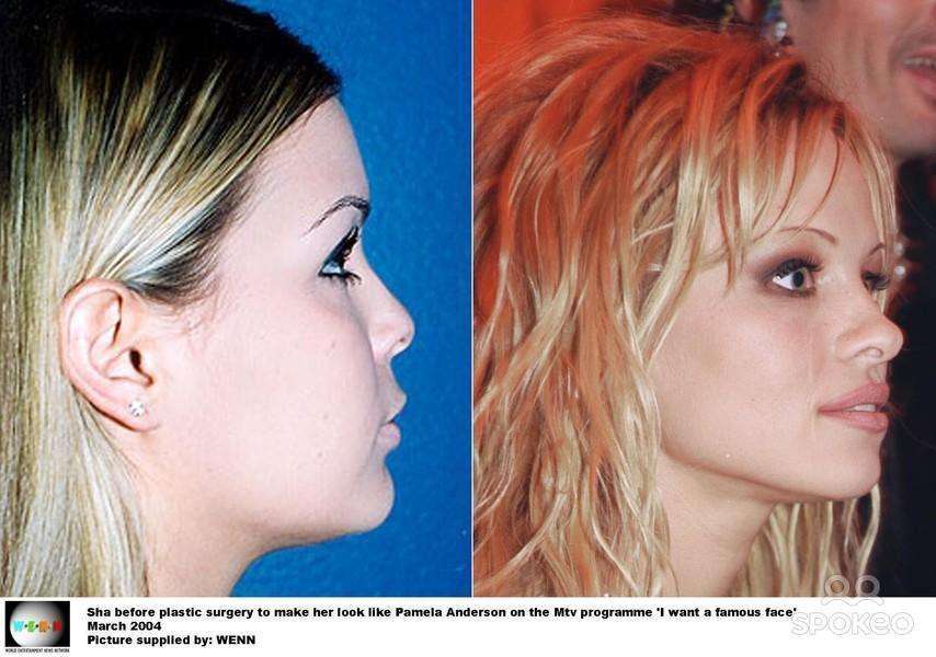 cewek oplas mirip artis © 2016 brilio.net cewek oplas mirip artis © 2016 brilio.net