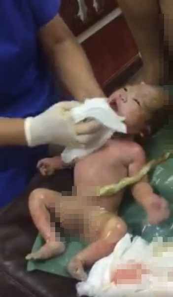 Usaha dokter selamatkan bayi ini bikin tegang dan air mata menetes