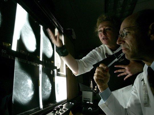 Ini alasan pemeriksaan mammogram tak pandang usia