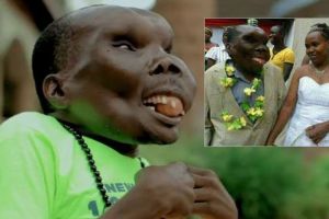 Ini kabar terbaru 'pria terjelek' di dunia, bikin nggak percaya