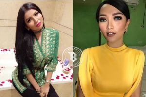 10 Seleb cantik ini blak-blakan lakukan 'tanam benang' demi kecantikan