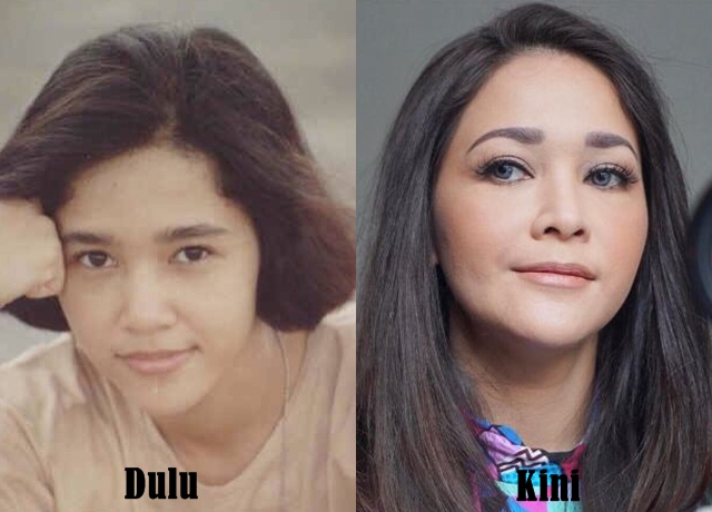 seleb tanam benang © 2017 brilio.net seleb tanam benang © 2017 brilio.net
