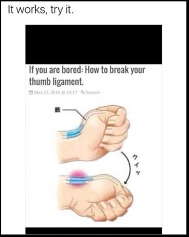 jempol remaja ini jadi mengerikan © 2017 twitter