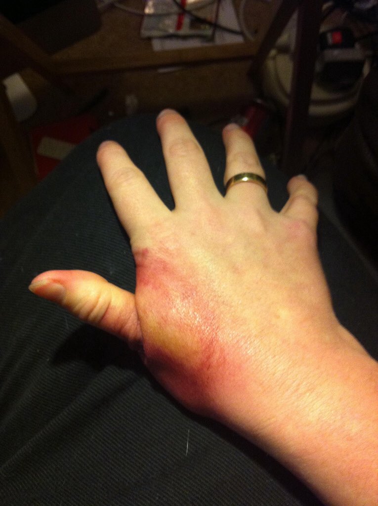 jempol remaja ini jadi mengerikan © 2017 twitter