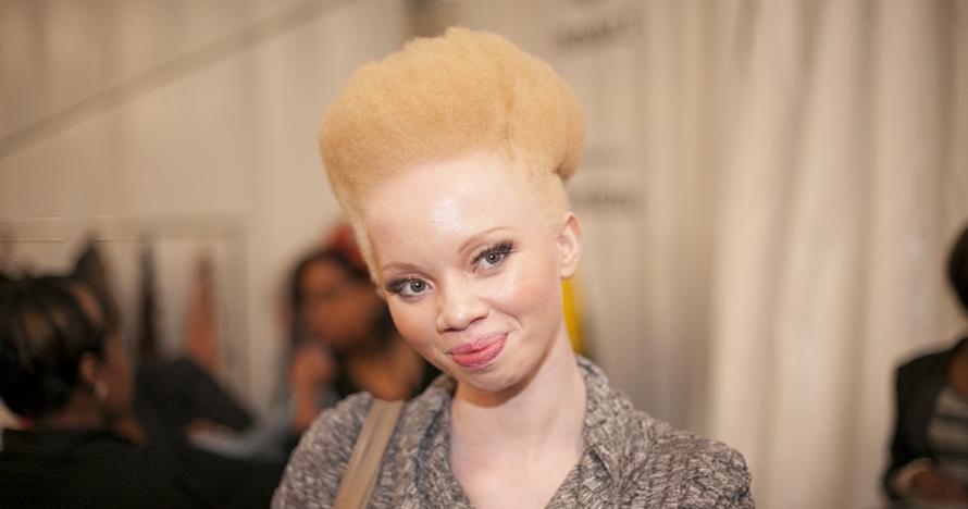 Thando Hopa, model albino sekaligus pengacara sukses dari Afrika