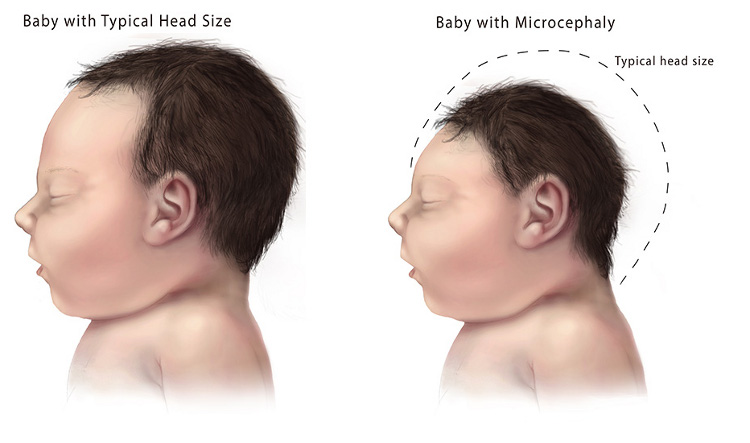 fakta virus Zika  © 2017 wittyfeed.com