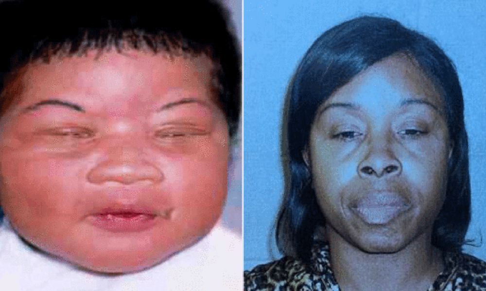 Gadis yang diculik saat lahir ini bertemu keluarga setelah 18 tahun