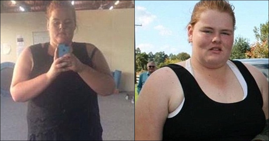 Jadi korban bullying, remaja ini berhasil turun 50 kg dalam 18 bulan