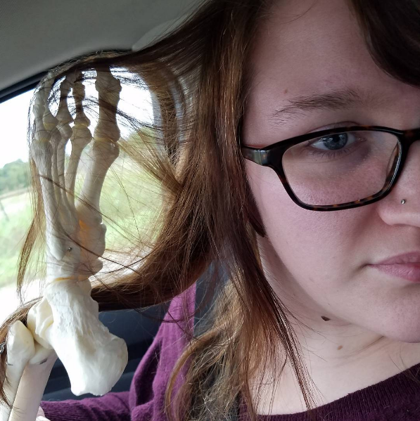 traveling kaki amputasi © 2017 brilio.net