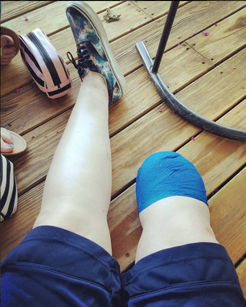 traveling kaki amputasi © 2017 brilio.net