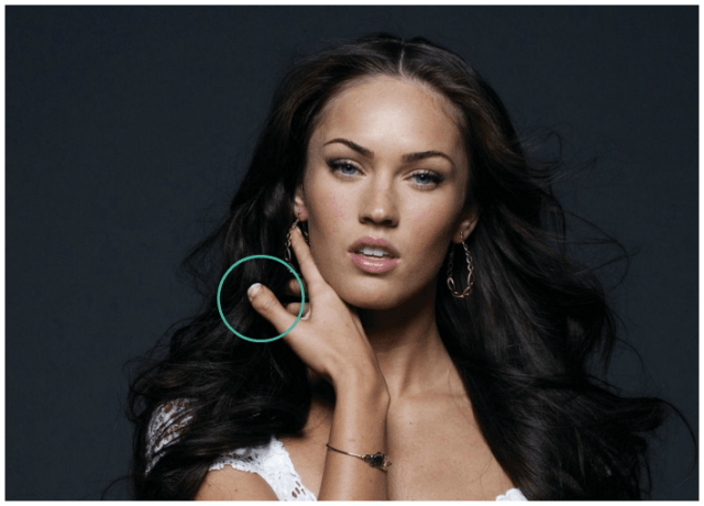 seleb yang miliki cacat  © 2017 berbagai sumber