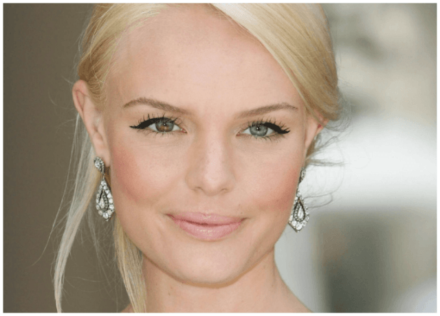 seleb yang miliki cacat  © 2017 berbagai sumber