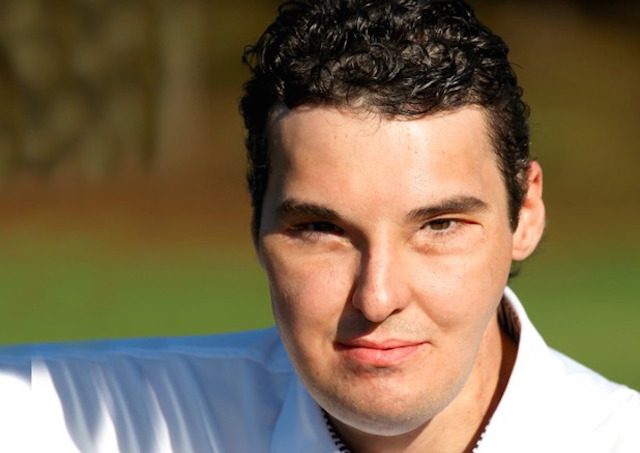 tetap hidup meski kepalanya tertembak © 2017 toptenz.net