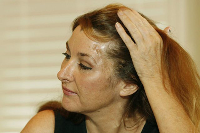 tetap hidup meski kepalanya tertembak © 2017 toptenz.net