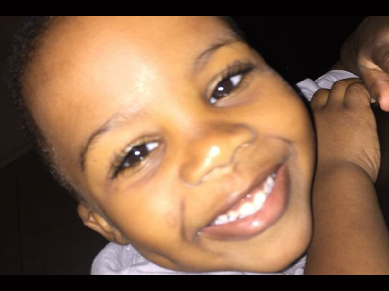 tetap hidup meski kepalanya tertembak © 2017 toptenz.net