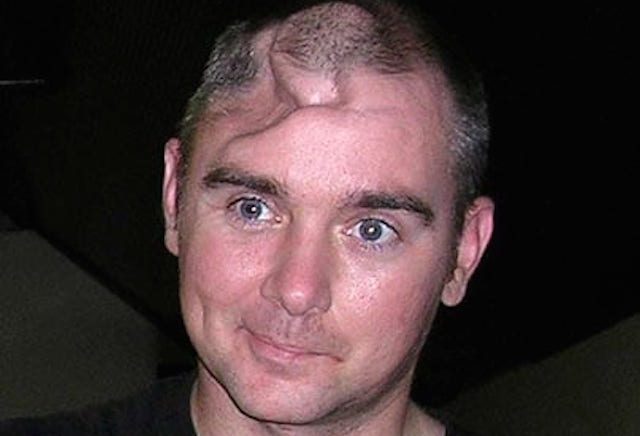 tetap hidup meski kepalanya tertembak © 2017 toptenz.net