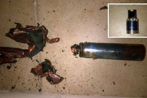 Pria ini kehilangan 7 gigi akibat hisap rokok elektrik, ngeri banget