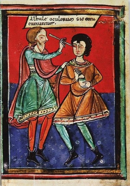 17 Ilustrasi pengobatan abad pertengahan ini bikin susah tidur