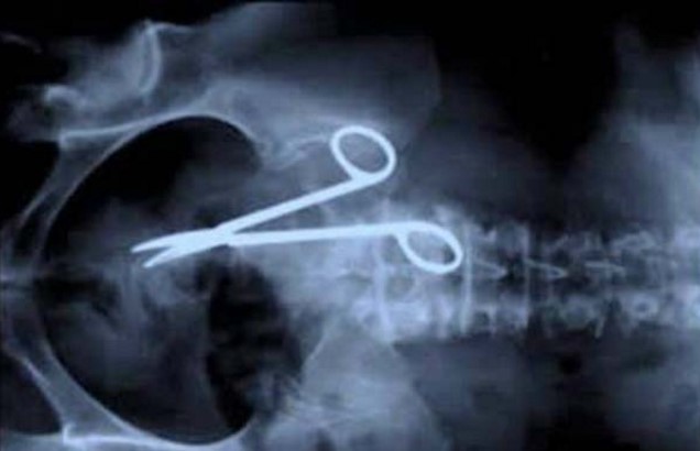 hasil xray © 2017 brilio.net hasil xray © 2017 brilio.net