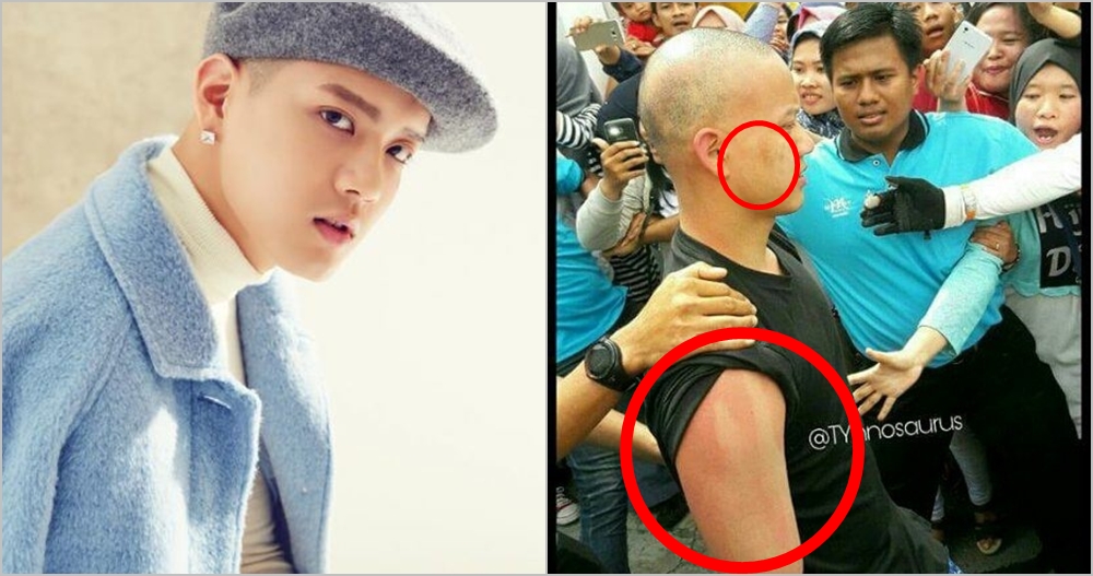 idol korea dikasarin © 2017 brilio.net idol korea dikasarin © 2017 brilio.net