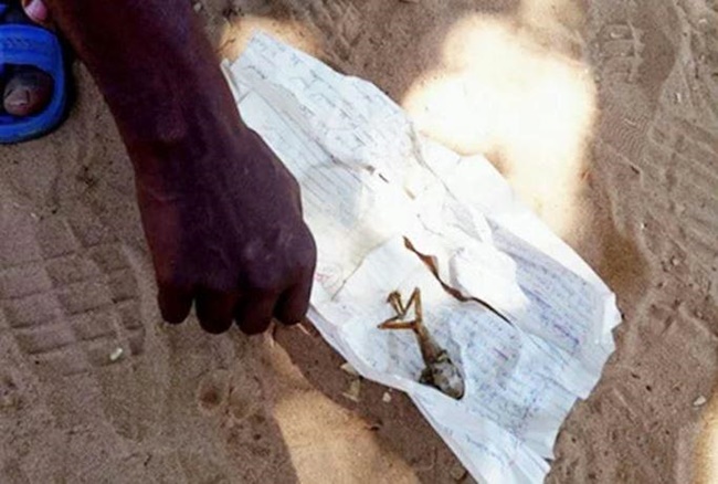 Bayi mirip katak  © 2017 brilio.net