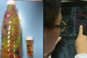 Dikira permen, orangtua ini malah beri bola polimer untuk dimakan anak