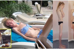 Divonis usianya tinggal 48 jam, gadis ini perlahan berubah jadi cantik