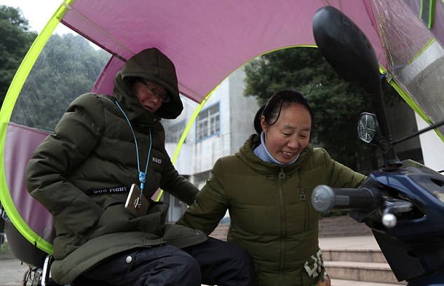 Mei Xiao penyakit  epidermolysis bullosa © 2017 dailystar.co.uk