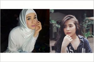 8 Artis cantik ini khas dengan kumis tipis, makin manis deh