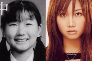 Transformasi 10 seleb Jepang sebelum dan sesudah operasi plastik