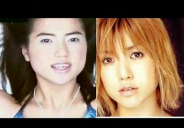 Transformasi 10 seleb Jepang sebelum dan sesudah operasi plastik