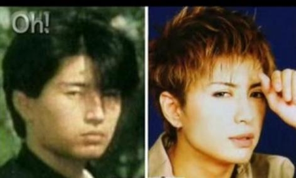 Transformasi 10 seleb Jepang sebelum dan sesudah operasi plastik