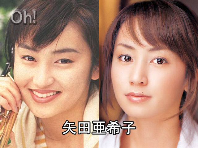 Transformasi 10 seleb Jepang sebelum dan sesudah operasi plastik