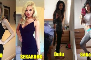 13 Potret pemulihan anoreksia ini bukti sehat lebih penting dari diet