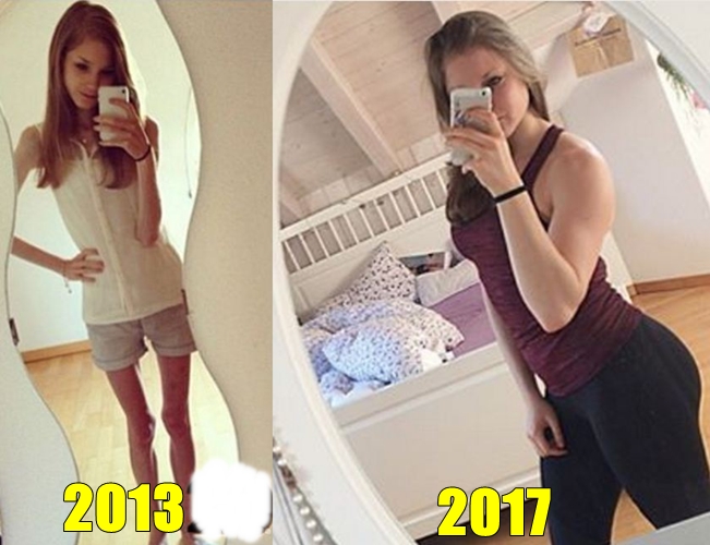 13 Potret pemulihan anoreksia ini bukti sehat lebih penting dari diet