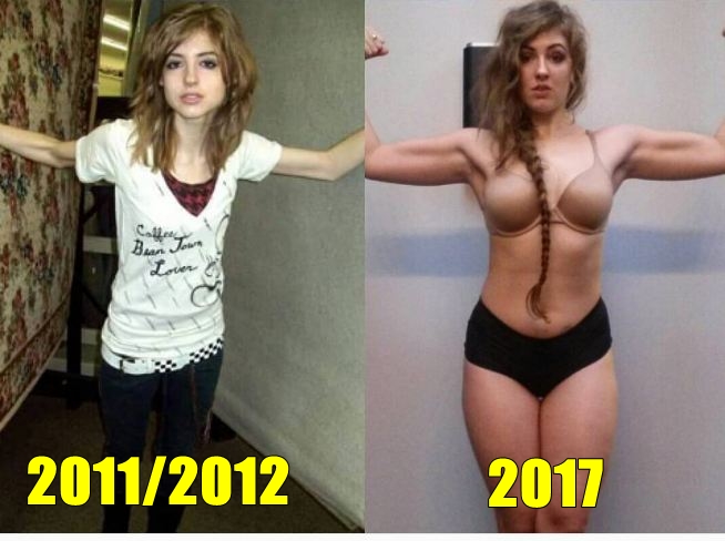 13 Potret pemulihan anoreksia ini bukti sehat lebih penting dari diet