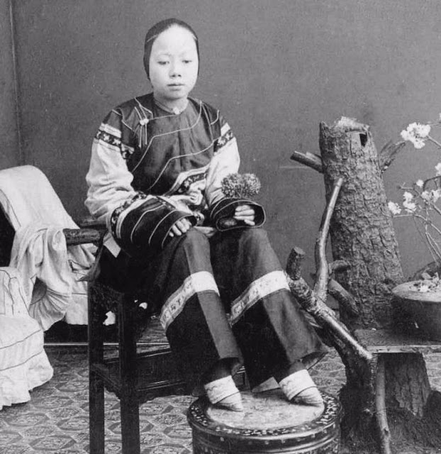 15 Potret wanita China berkaki kecil ini bikin ngilu lihatnya