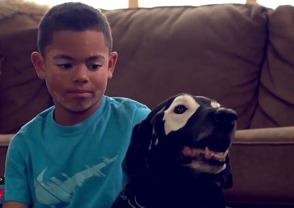 Dijauhi teman sebaya karena vitiligo, bocah ini berkawan dengan anjing