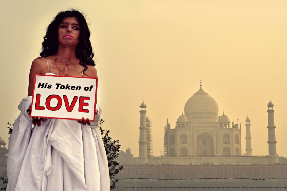 15 Potret menyentuh korban siraman air keras, bukti hati wanita kuat