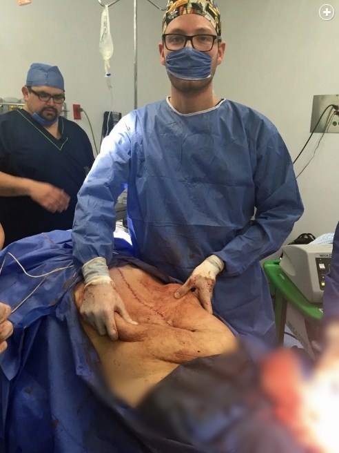 12 Foto ini tunjukan proses operasi kista sebesar 33 kg, menegangkan!